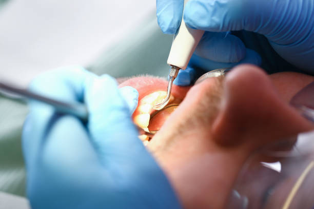Best Urgent Care for Lost Fillings or Crowns in Woodville, OH